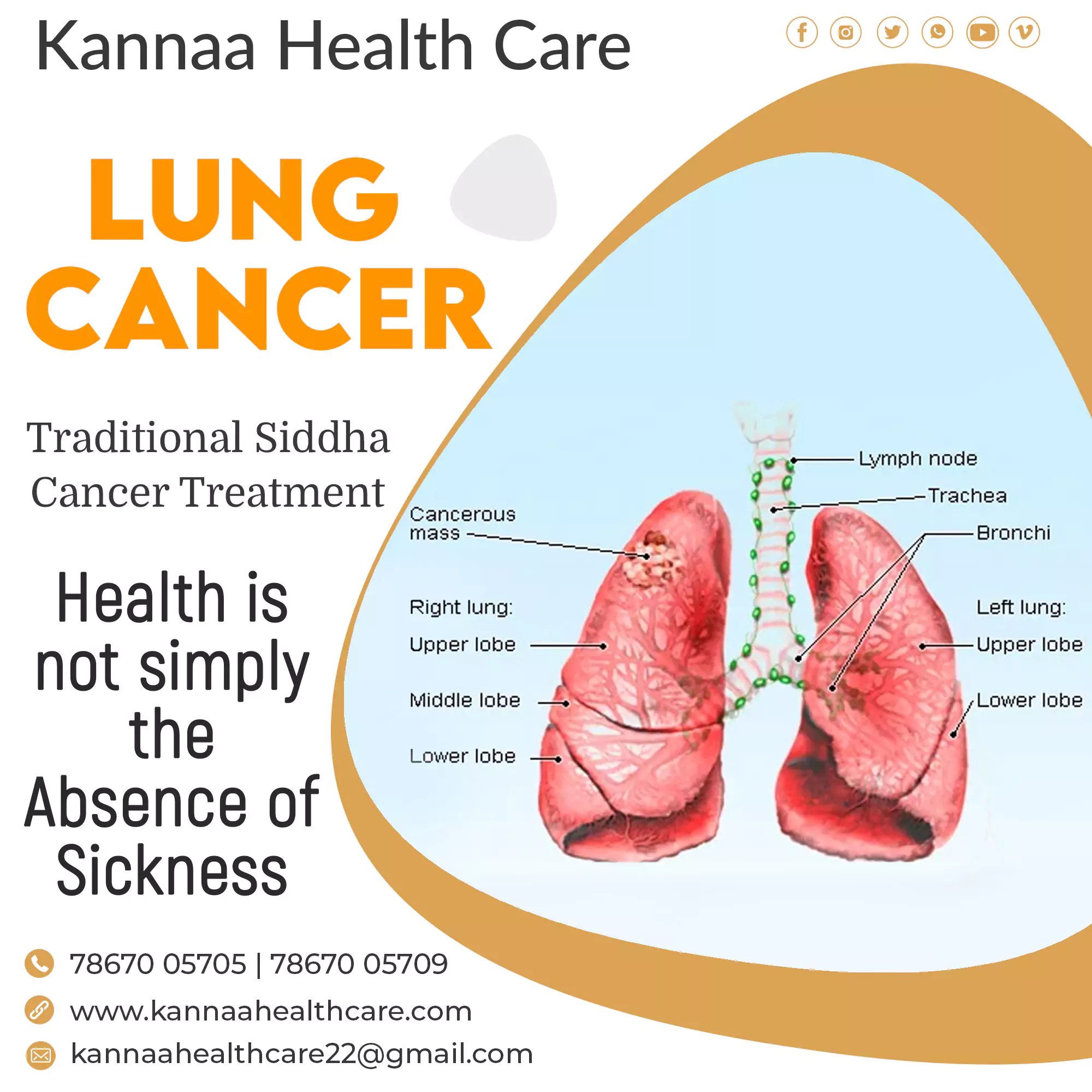 Lung Cancer treatments